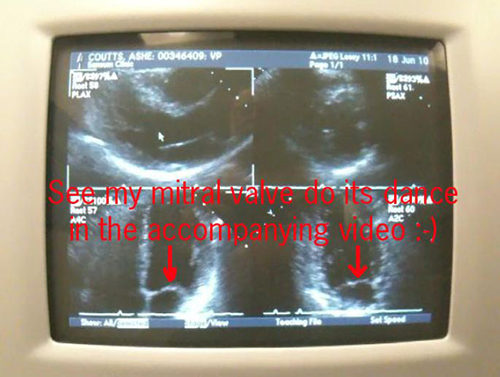 Cardio Test June 18, 2010